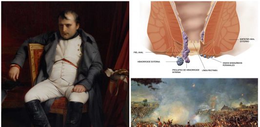 El fin de Napoleón en Waterloo fue por culpa de las hemorroides El fin de Napoleón en Waterloo fue por culpa de las hemorroides
