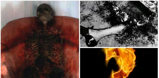 3 casos recientes de combustión espontánea 3 casos recientes de combustión espontánea