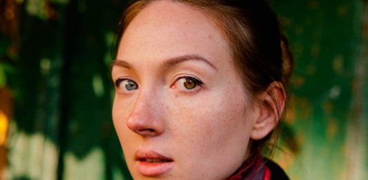 ¿Por qué algunas personas tienen un ojo de cada color?