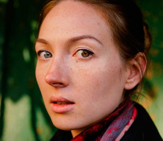 Heterocromia | ¿Por qué las personas tienen ojos de diferente color? ¿Por qué algunas personas tienen un ojo de cada color?