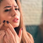 acné, chocolate causa acné, no