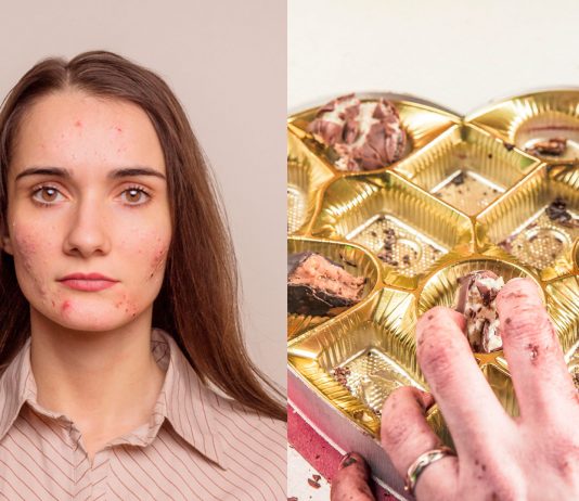 ¿Es cierto que el chocolate causa acné? Aquí tienes la respuesta ¿Es cierto que el chocolate causa acné? Aquí tienes la respuesta