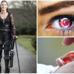 Cuerpo biónico. 4 maravillas médicas que traen las nuevas tecnologías