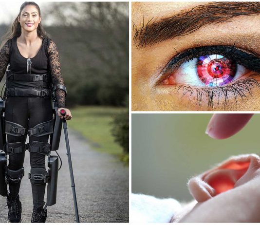 Cuerpo biónico | 4 Maravillas médicas que traen las nuevas tecnologías Cuerpo biónico. 4 maravillas médicas que traen las nuevas tecnologías