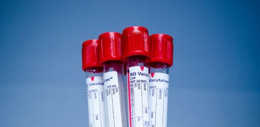 ¿Sabías que hay una dieta para tu tipo de sangre? Conoce al respecto