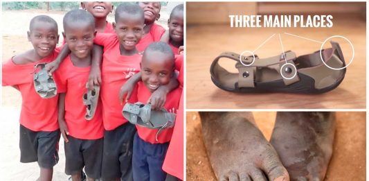 Los increíbles zapatos que crecen con el niño