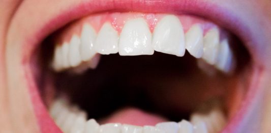 4 mitos sobre el mal aliento que todavía creíamos