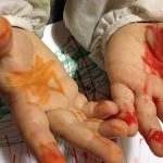 A los niños les puede volver a crecer la punta de los dedos