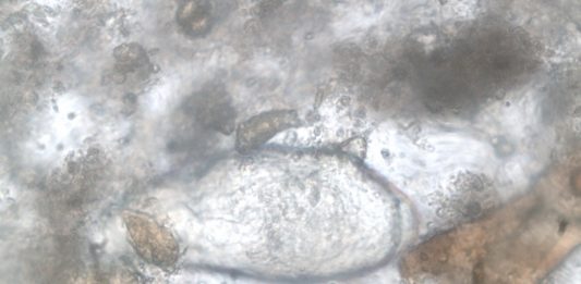 Los peores parásitos que puedes contraer y cómo evitarlos