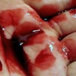 MANO