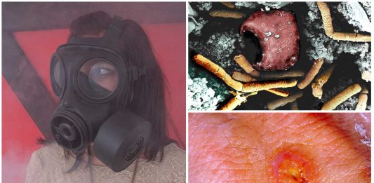 3 terribles enfermedades, potenciales armas biológicas