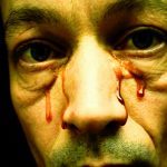 ¿Se puede sudar sangre? Descubre la Hematohidrosis, una extraña enfermedad