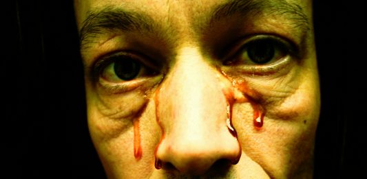 ¿Se puede sudar sangre? Descubre la Hematohidrosis, una extraña enfermedad