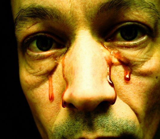 ¿Se puede sudar sangre? Descubre la Hematohidrosis, una extraña enfermedad ¿Se puede sudar sangre? Descubre la Hematohidrosis, una extraña enfermedad