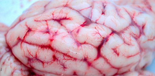 El banco de cerebros de la Universidad de Harvard