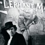 El Hombre Elefante, 10 curiosidades sobre su vida