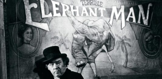 El Hombre Elefante, 10 curiosidades sobre su vida