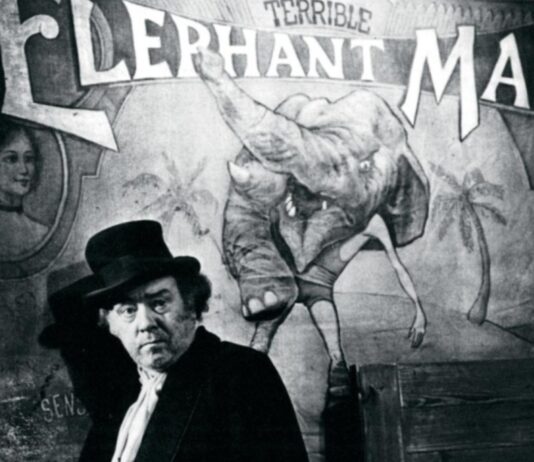 El Hombre Elefante, 10 curiosidades sobre su vida