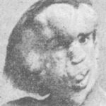 Interno en el hospital