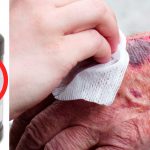 Por-qué-NO-debes-poner-peróxido-de-hidrógeno-en-las-heridas