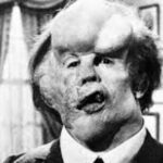 curiosidades sobre el Hombre Elefante