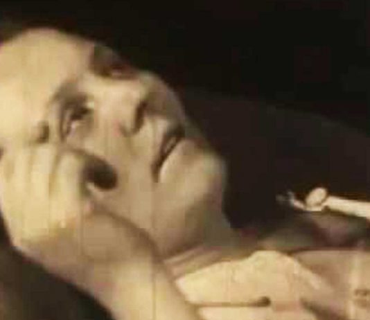 Encephalitis lethargica. La plaga que te dormía durante décadas