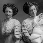 La triste historia de Rosa y Josepha Blazek, las siamesas de Bohemia