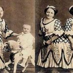 La triste historia de Rosa y Josepha Blazek, las siamesas de Bohemia