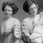 La triste historia de Rosa y Josepha Blazek, las siamesas de Bohemia