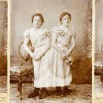 La triste historia de Rosa y Josepha Blazek, las siamesas de Bohemia