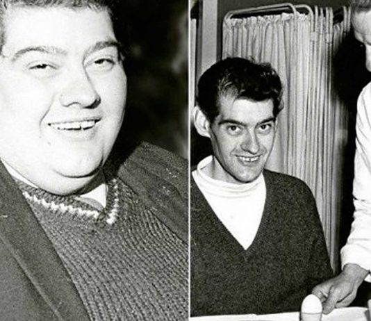 La loca historia de Angus Barbieri | Un año sin comer sólidos para adelgazar La loca historia de Angus Barbieri | Un año sin comer sólidos para adelgazar
