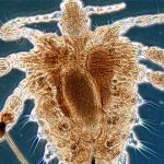 clases de piojos 000