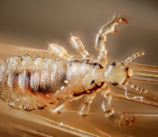 4 clases de piojos que debes conocer | ¿Habías oído hablar de ellas? clases de piojos