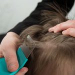 de dónde salen los piojos
