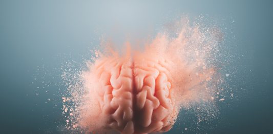 cerebros humanos más extraños