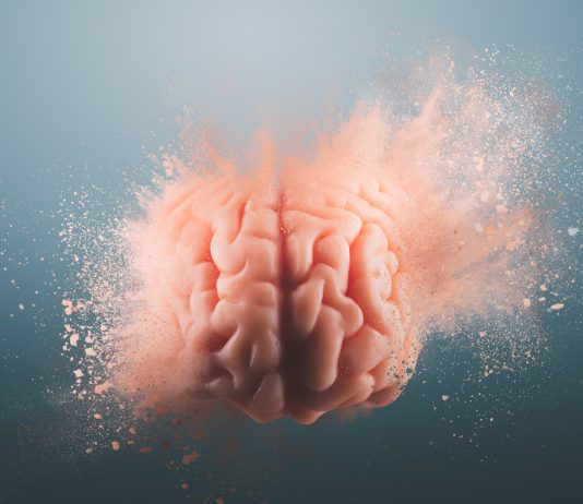 cerebros humanos más extraños