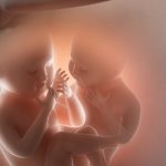curiosidades de los fetus in fetu2