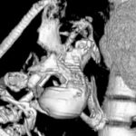 curiosidades de los fetus in fetu3