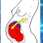 Microquimerismo | Células del bebé que modifican el ADN de su madre