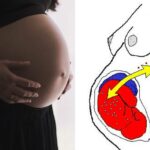 Microquimerismo | Células del bebé que modifican el ADN de su madre