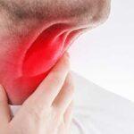 Síntomas de cáncer de garganta que podrían confundirse | ¿cuáles son?