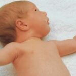 Hiperplexia, la enfermedad del sobresalto | Puede ser mortal