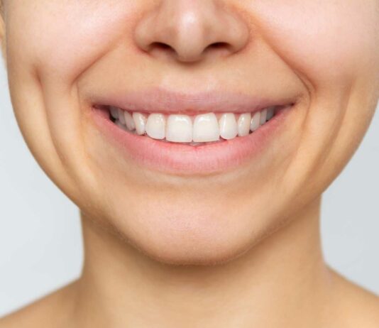 ¿CUÁNTO VALE PONERSE LAS FAMOSAS CARILLAS DENTALES? datos curiosos de los dientes