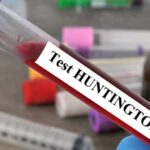 enfermedad-de-Huntington