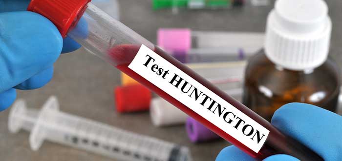 enfermedad de Huntington