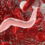 Enfermedad del Sueño | Qué es, causas y síntomas