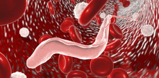 Enfermedad del Sueño | Qué es, causas y síntomas Enfermedad del Sueño | Qué es, causas y síntomas