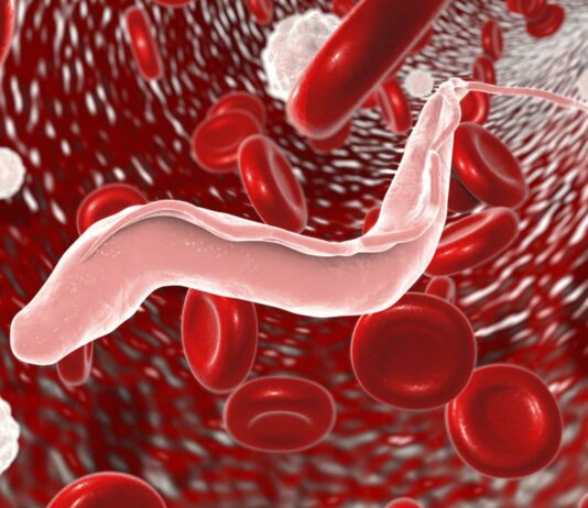 Enfermedad del Sueño | Qué es, causas y síntomas