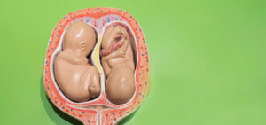 Curiosidades del Embarazo | embarazo multiple