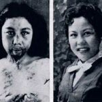 Doncellas de Hiroshima | La histoira de 25 jóvenes afectadas por la Bomba